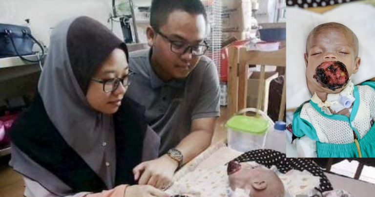 Ya Allah, Beratnya Dugaan Ainul Mardhiah Dan Ibu Bapanya, Moga Allah Beri Kekuatan Kepada Keluarga Ini