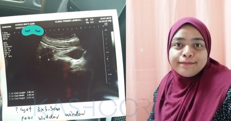 “Kalau Sayang Rahim, Elak Terus Buat 7 Perkara Ni” Pesan Wanita Ini Yang Pernah Hidap Cyst Beberapa Kali