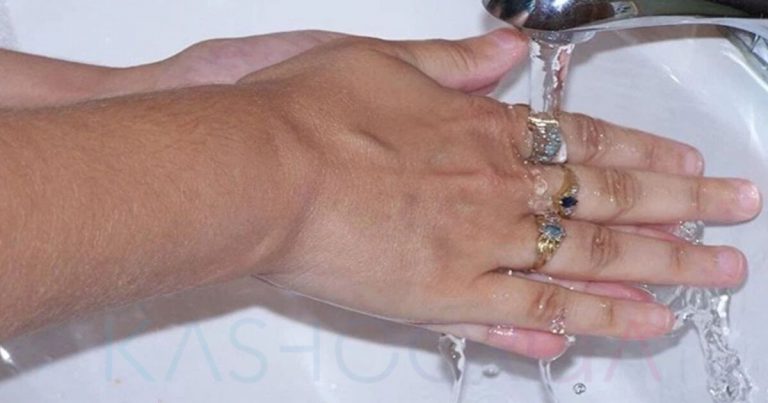 Hukum Berwuduk Dengan Memakai Cincin, Sah Atau Tidak? Ini Penjelasannya!