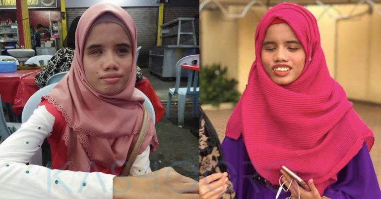 “Tak Minta Dilahirkan Begini” – Gadis OKU Ini Alami Trauma Sebab Pernah Dicaci Minta Air Tengah Sakit