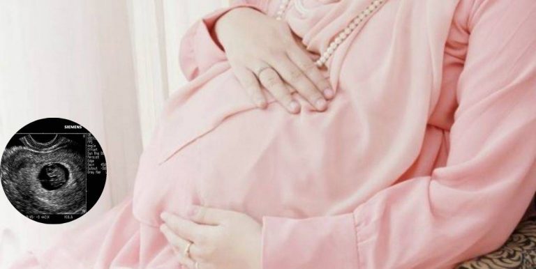 Jangan Budayakan Tunjuk Baby Bump Di Media Sosial Kerana Ia AURAT WANITA