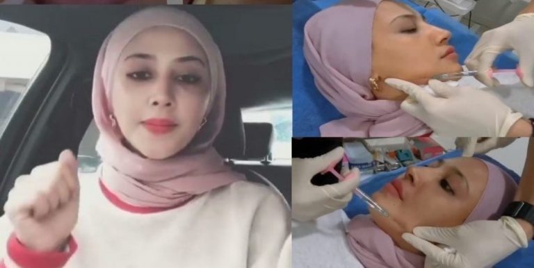 Suntik Kolagen Haram! Mufti WP Jelaskan 5 Lagi Perbuatan Haram Wanita Lakukan Termasuk Pakai Blusher Jika Masih Single