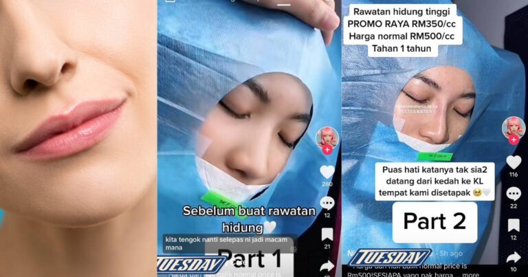 ‘Promo Tinggikan Hidung Serendah RM350.’ Ciptaan Allah Maha Sempurna, Mana Mungkin Manusia Mampu Tandingi