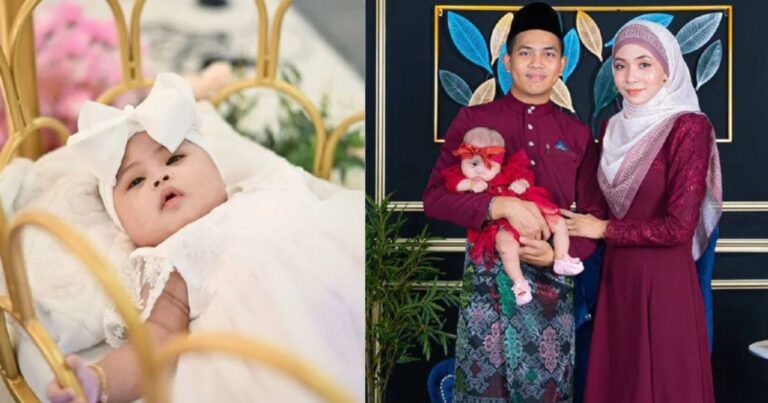 ‘Tiada Perasaan Malu, Tapi Bersyukur Dikurniakan Anak Istimewa.’  Anak Sindrom Down Anugerah Allah